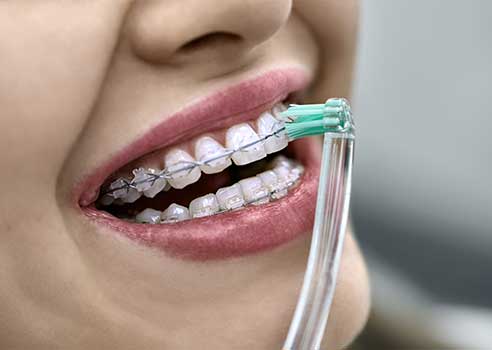 Orthodontics Hampden Dentistry & Orthodontics Denver CO
